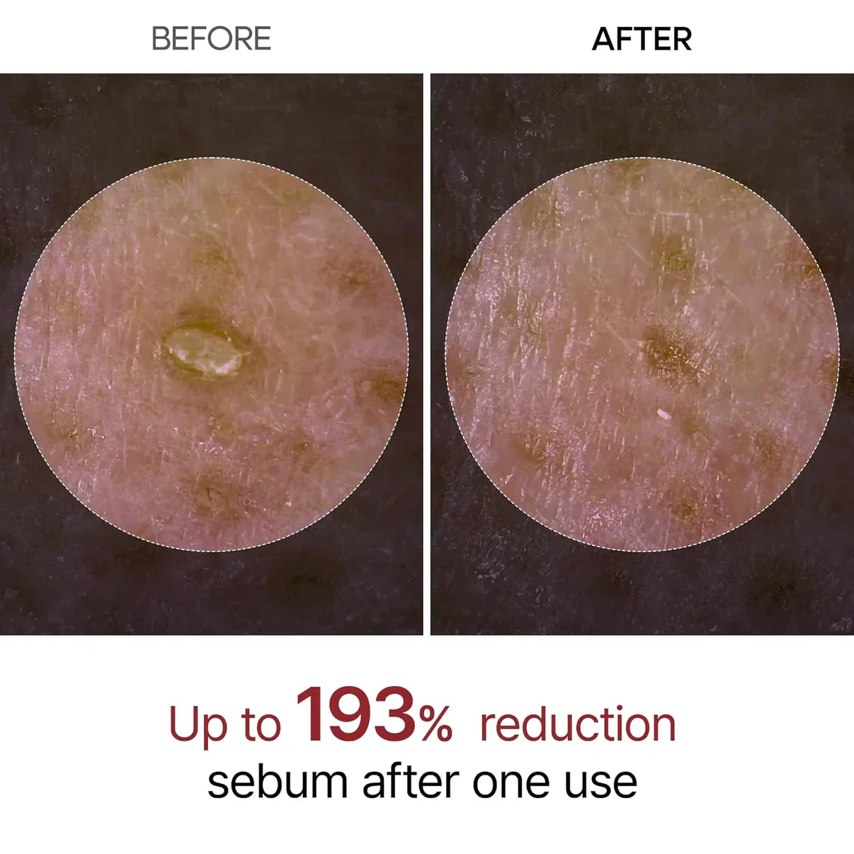 Rice Peel Glow Serum Ampoule (BUY 1 GET 1 FREE)