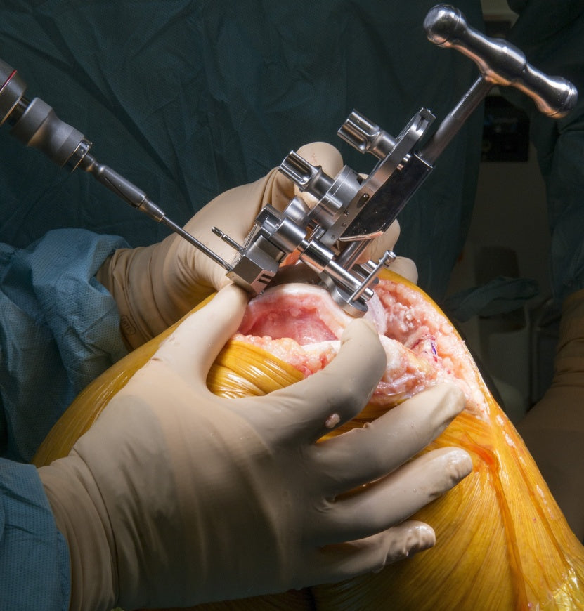 ROH-Birmingham_Vanguard-Total-Knee-Replacement-Cruciate-Retaining-Zimmer-Biomet_Faisal-Hussain_05.10.2017-32-e1521113594222-831x870.jpg__PID:76306c70-42be-4862-9457-f66adea11e0f