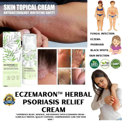 Ecze+ Anti Fungal And Psoriasis Spray