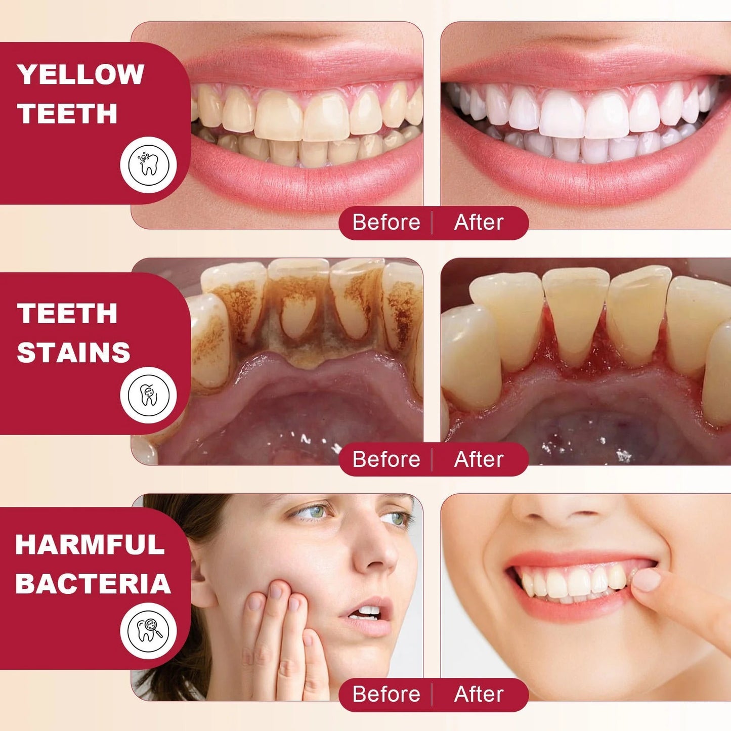 Elamei SP4 Ultra+ Whitening Toothpaste - Herbal Ingredients (Buy 1 Get 1 Free @399)