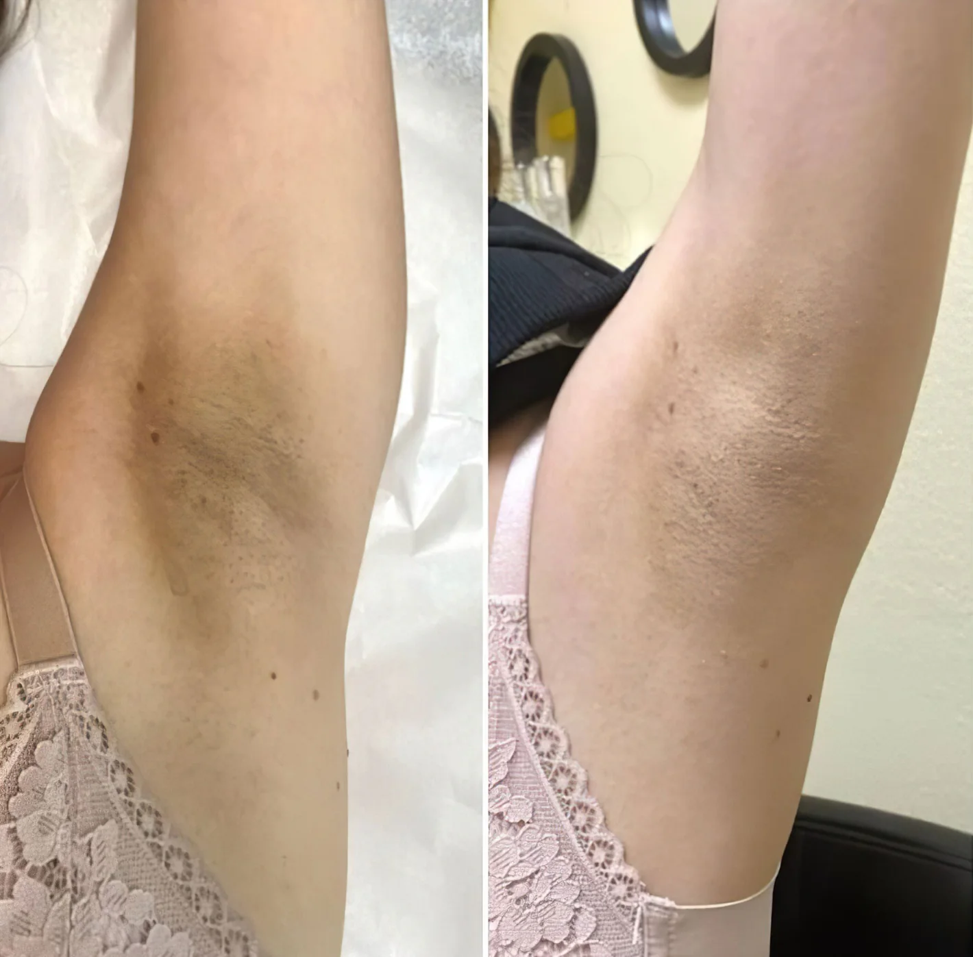 Rice Peel Glow Serum Ampoule (BUY 1 GET 1 FREE)