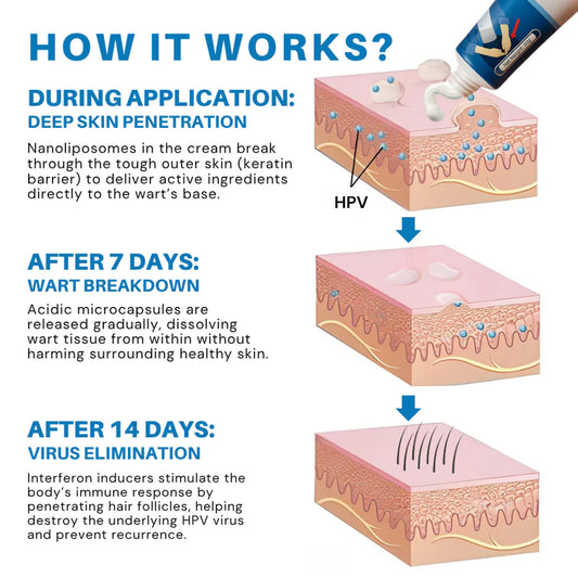 HPV Genital Warts Relief Cream