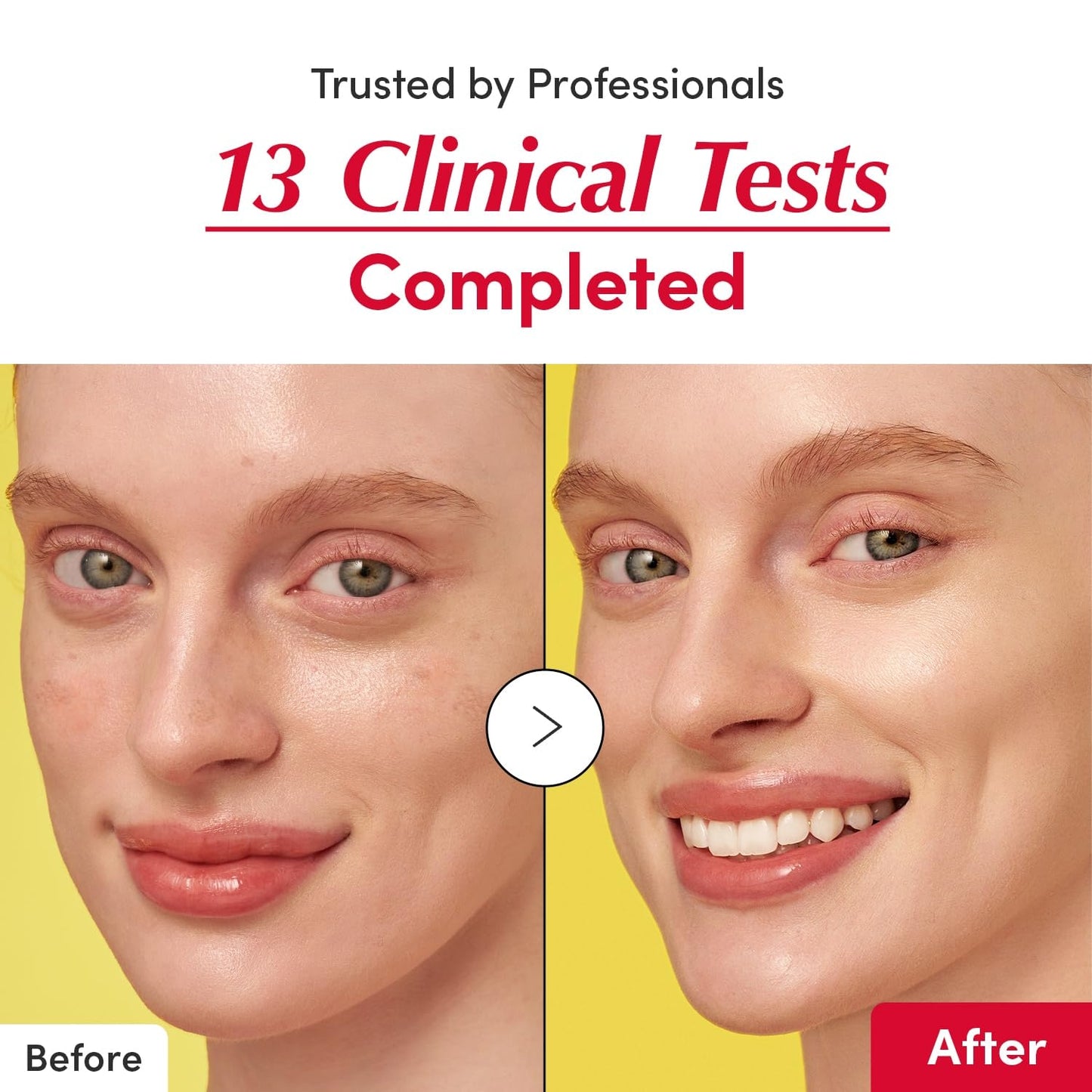 Vitamin Illuminating Serum – Brightening Vitamin C Serum with Niacinamide | Strengthens skin barrier | Hydrates using Ceramide and Hyaluronic Acid